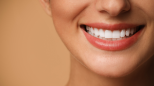 Benefits of a Beautiful Smile