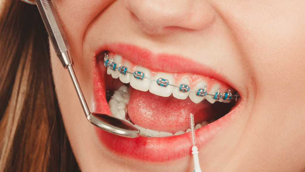 best dental care in kottiyam